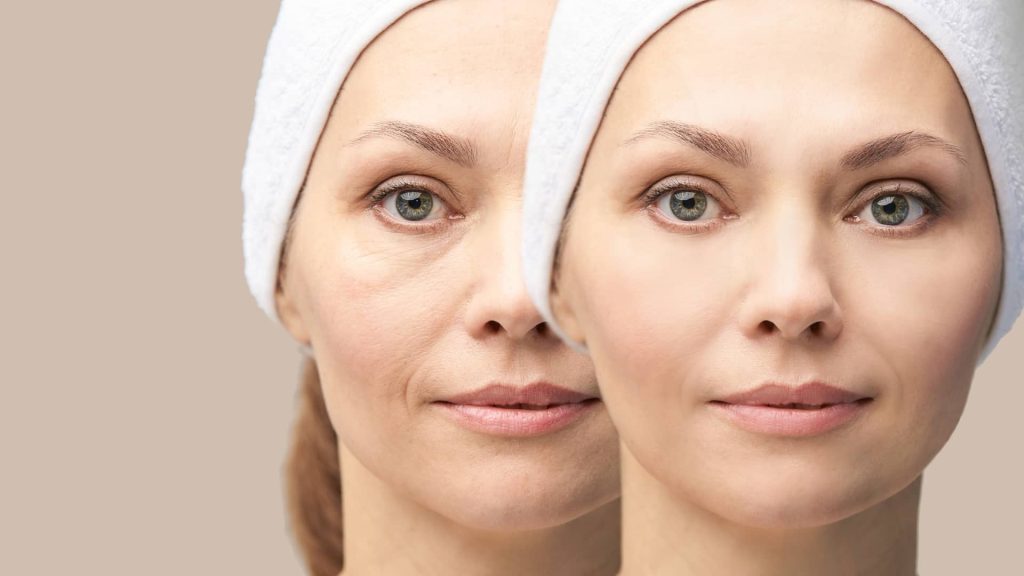 Middle-aged caucasian woman before and after ageing skin treatment on a beige background